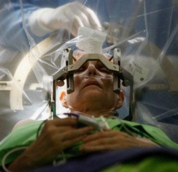Tratamiento quirúrgico para absceso epidural