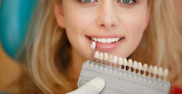blanqueamiento dental-clinica dental aviles-centro dental innova