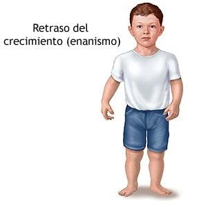 La deficiencia de la hormona del crecimiento, que es causada por una deficiencia en los centros hipotalámicos