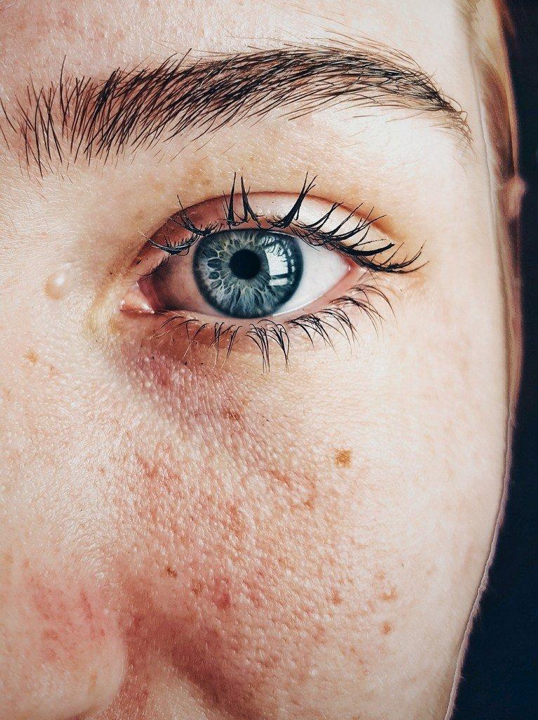 cremas despigmentantes efectivas