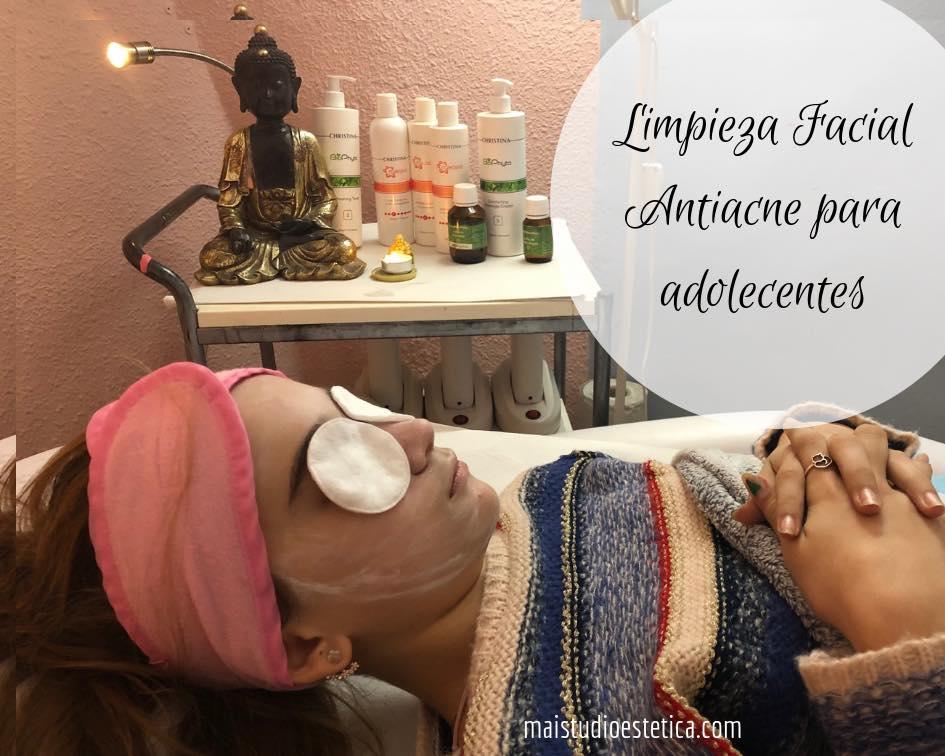 tratamiento antiacne