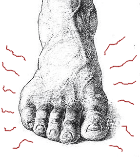 dolor en los pies