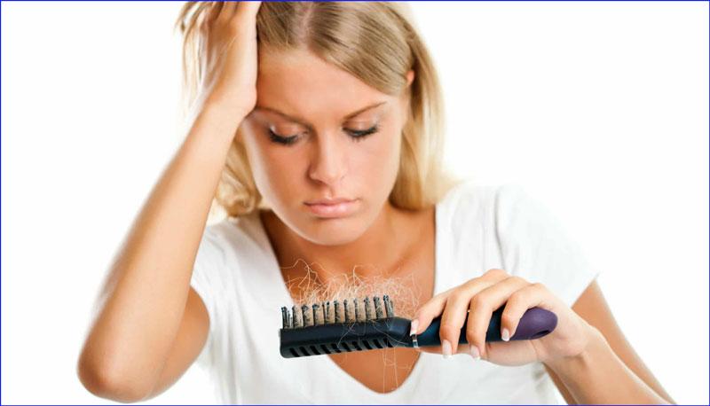 alopecia femenina autoinmune, alopecia femenina alimentacion, alopecia femenina cura