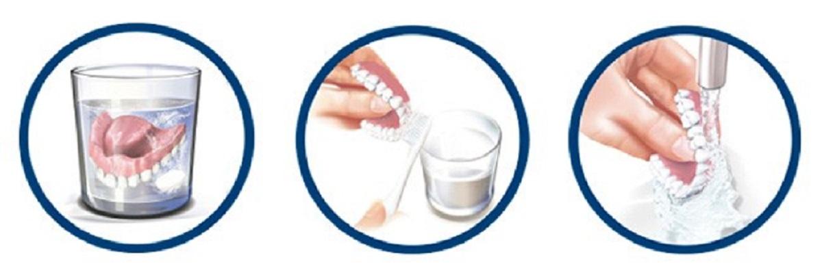 centro-dental-innova-clinica-dental-aviles-limpieza de protesis dental