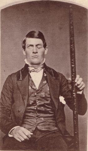 Phineas Gage, un caso básico de la clase de neurofisiología.