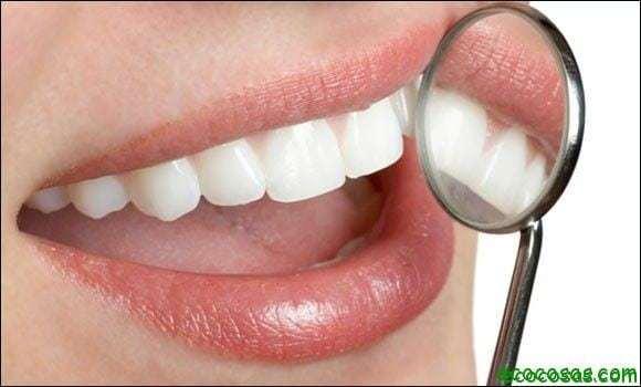 blanqueamiento dental en casa