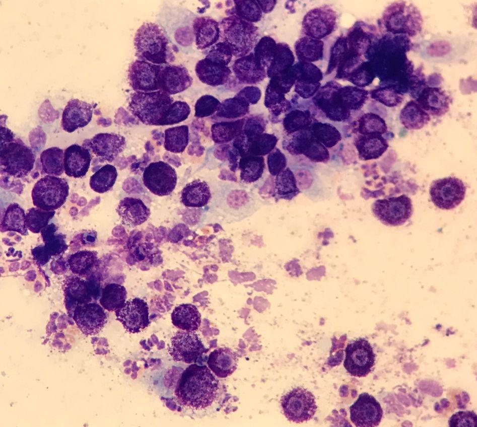 Citología de un Mastocitoma