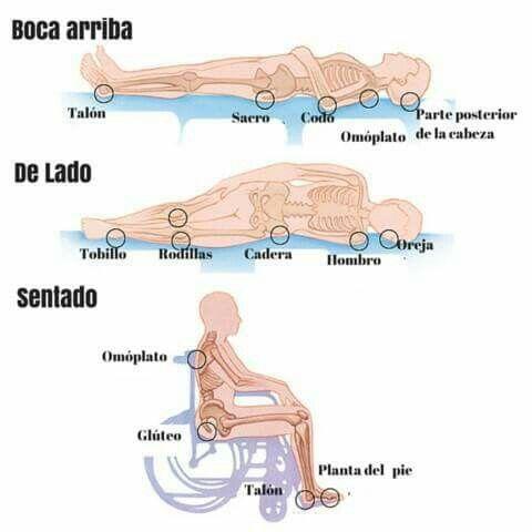 donde salen las llagas