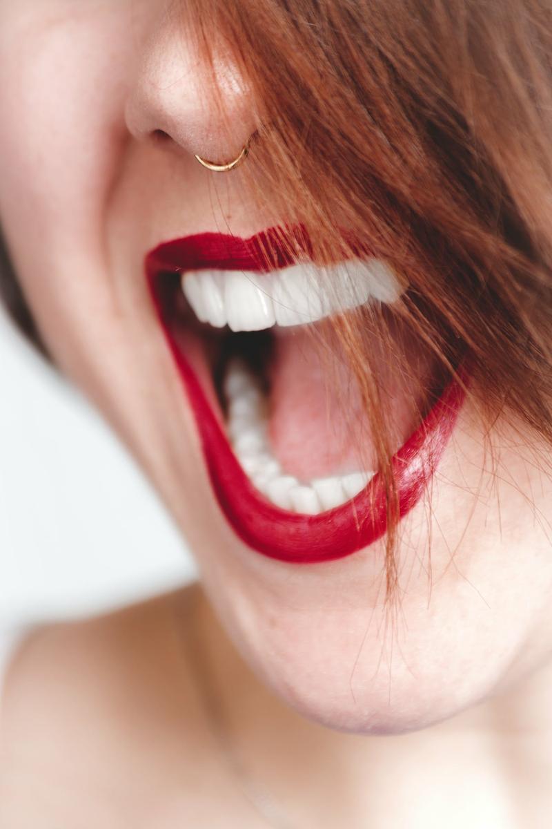 manchas blancas en los dientes
