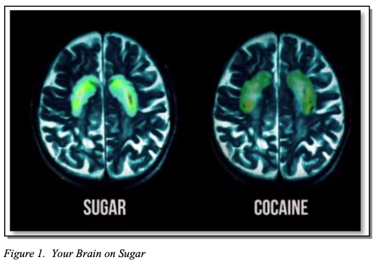 areas del cerebro que se activan con el azúcar y la coca