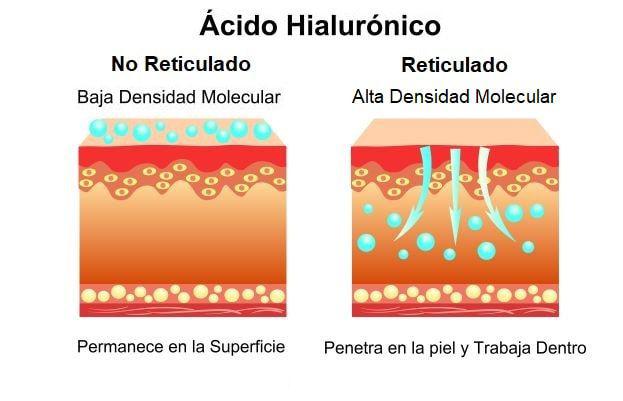 ácido hialurónico y sus tipos segun su densidad molecular