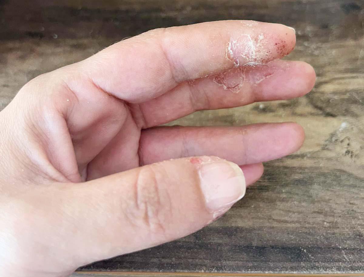 esmalte semipermanente daña las uñas