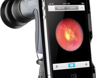 welch allyn iexaminer ¿Sabías que con un iPhone ya se pueden realizar exámenes oculares?