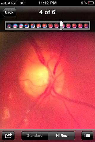 iexaminer app ¿Sabías que con un iPhone ya se pueden realizar exámenes oculares?