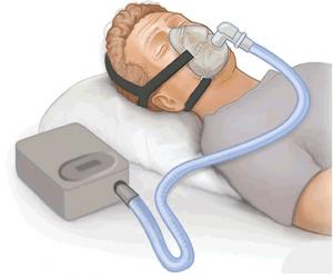 Aparatos para una correcta fisioterapia respiratoria 300x250 Dispositivos para una correcta Fisioterapia respiratoria