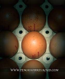 La homocisteína un factor de riesgo en la ansiedad