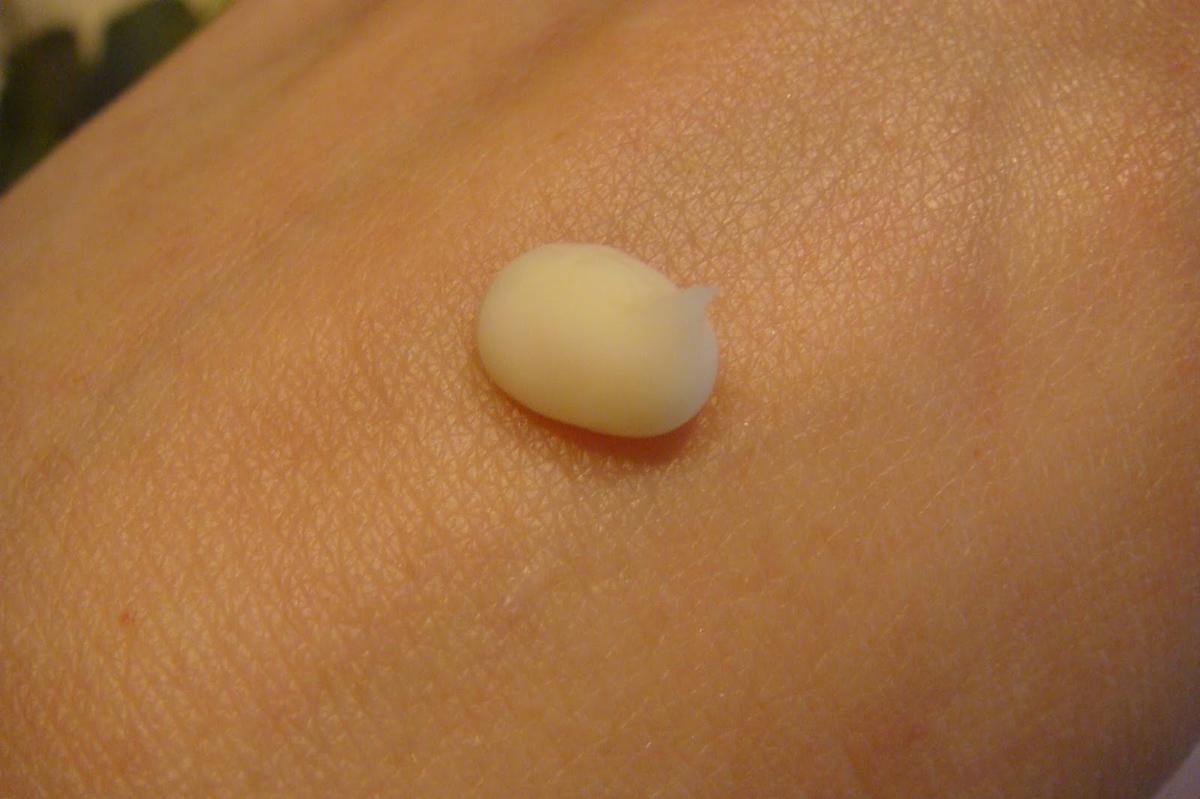 Lipolift Pómulos de IODASE