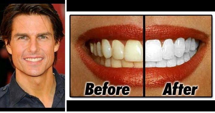 Di adiós a los dientes amarillos en 2 minutos, ¡apunta estos trucos!