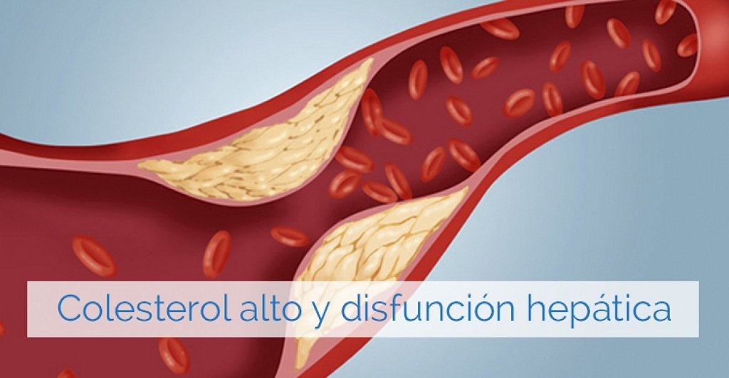 Síntomas Que Nos Alertan De Colesterol Alto Y Mal Funcionamiento Del Hígado Salud