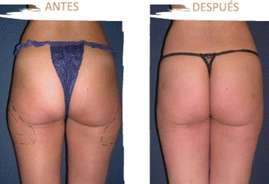 Imagen 2