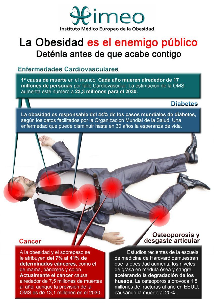 Sobrepeso y obesidad, cómo afecta a la salud Sobrepeso y obesidad, cómo afecta a la salud