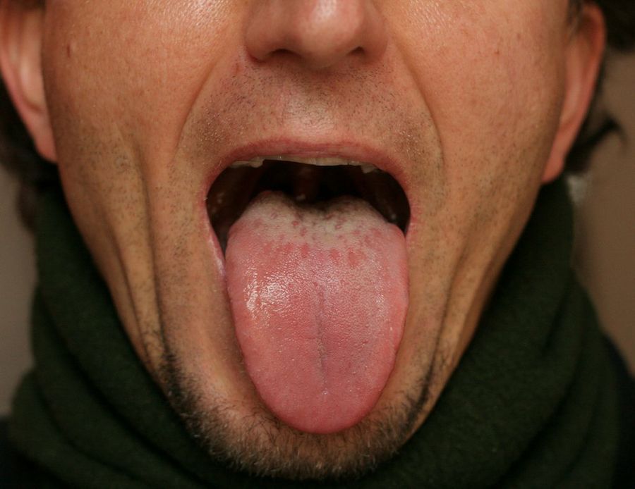 lengua