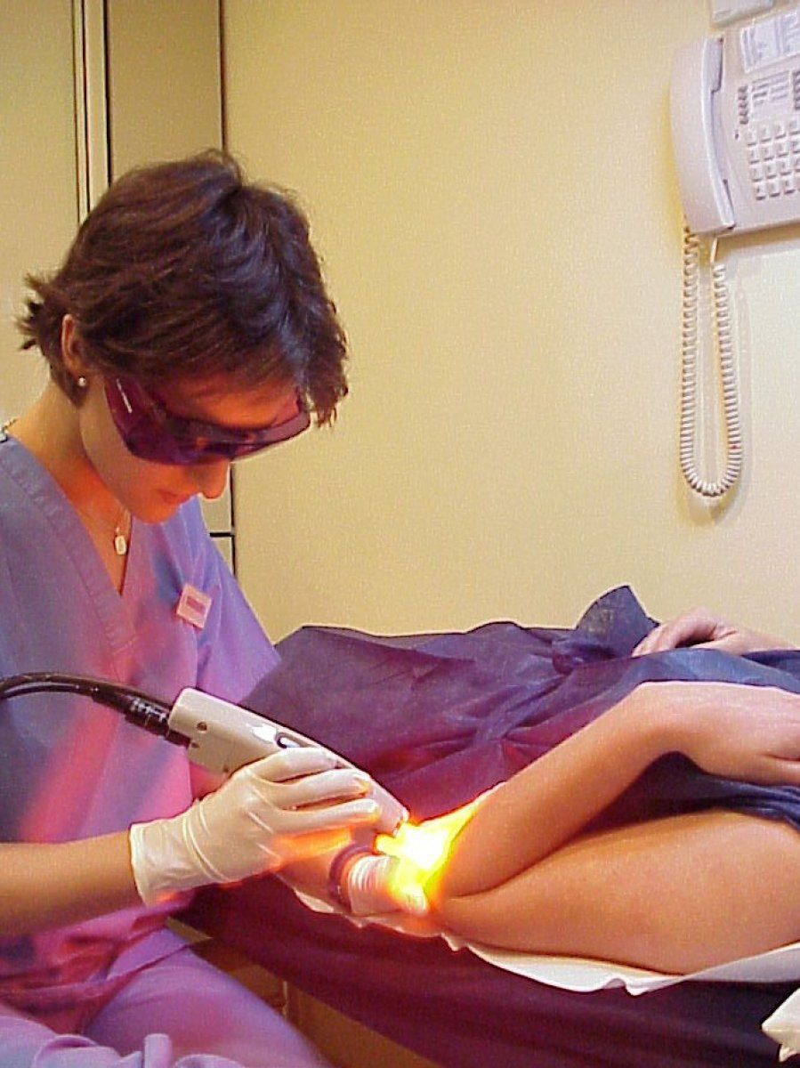 Fotodepilación profesional