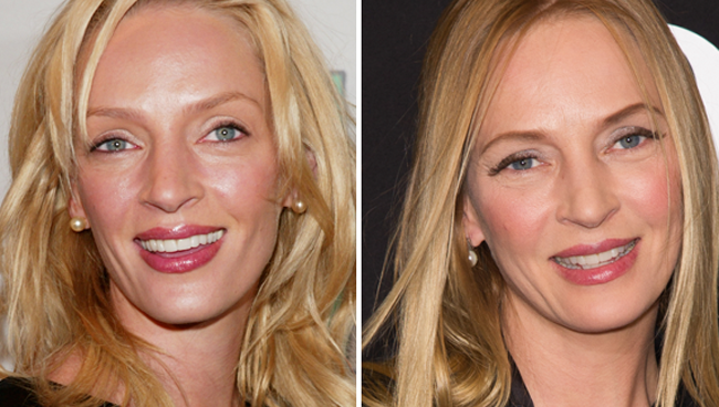 uma thurman operada La operación de Uma Thurman... ¿podría ser un montaje?