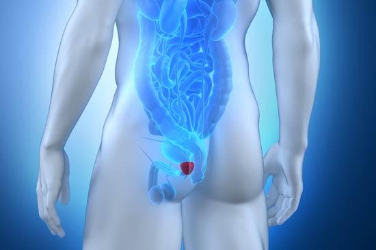 Prostatitis