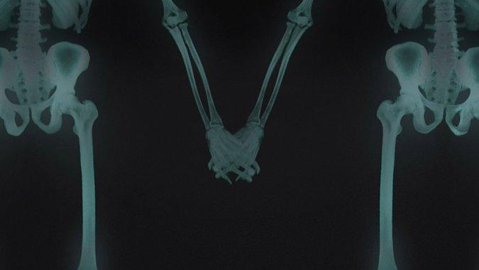 love-has-no-labels-lovelivedream-6