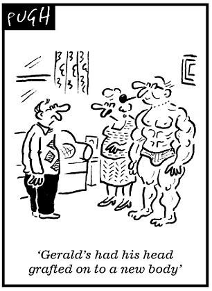 transplante de cabeza