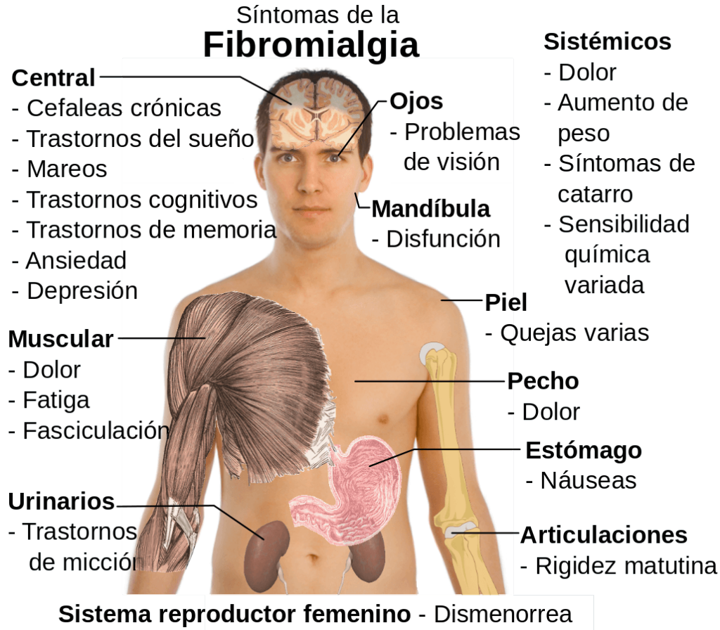 fibromialgia