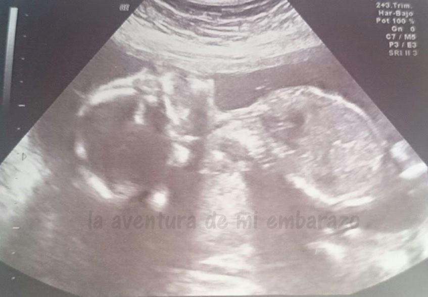  photo eco-20semanas_zpsbfvpnja9.jpg