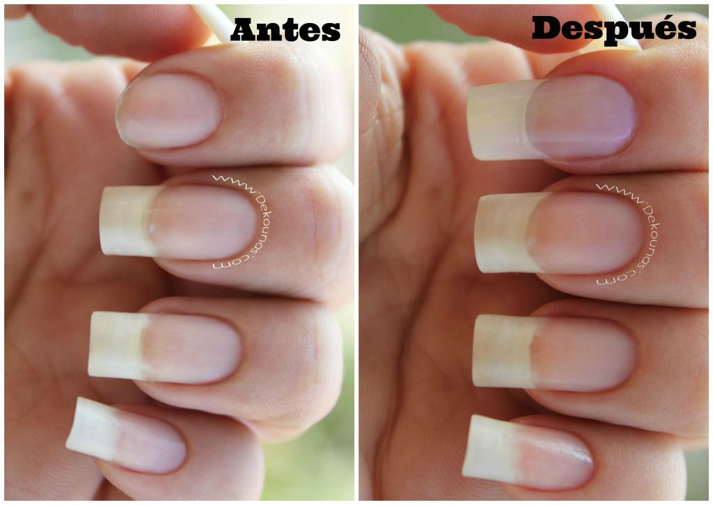 Antes y despues4