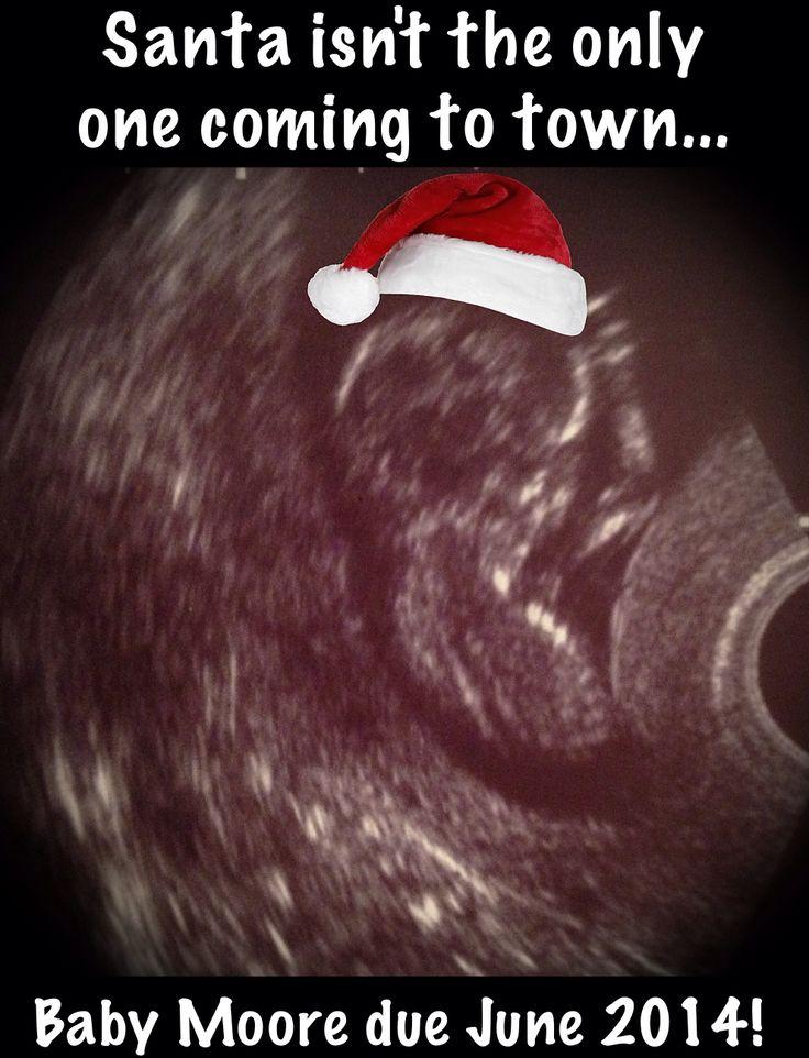 My Christmas Pregnancy Announcement