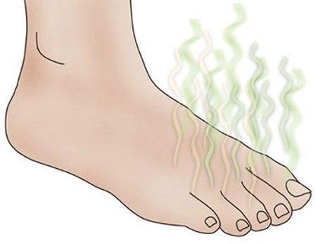 Remedios caseros para el olor de pies