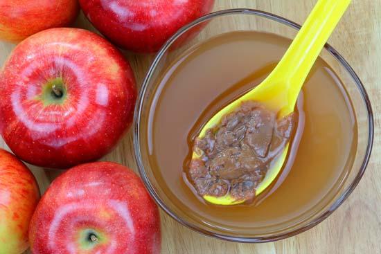 Vinagre de manzana
