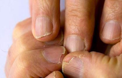 468c7b166a0b02307de40bddacd5cb74