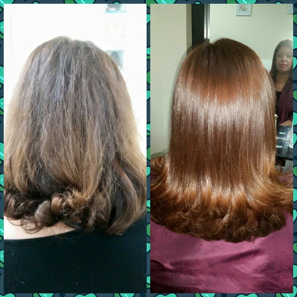 Antes y después del tratamiento.