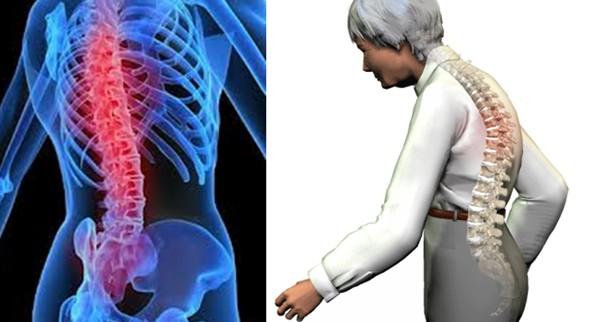 dolor columna vertebral