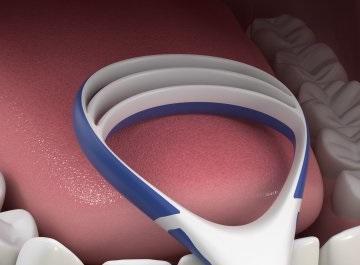 Limpiador de lengua o limpiador lingual