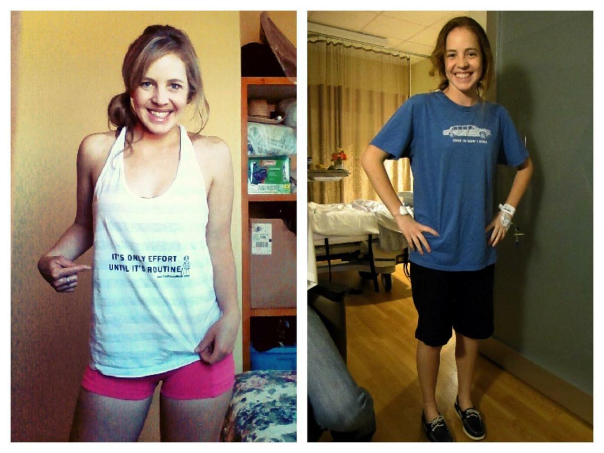 Mikaela - antes y después del protocolo autoinmune