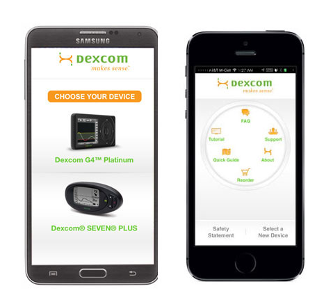 DEXCOM