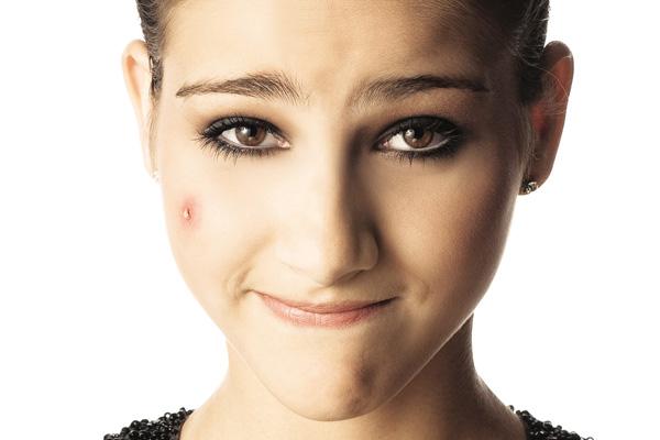 remover las espinillas