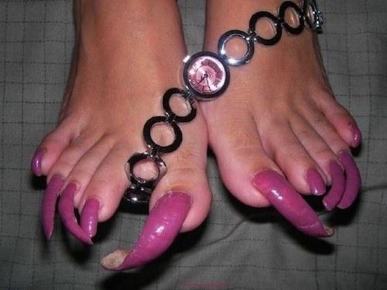 uñas de los pies horribles