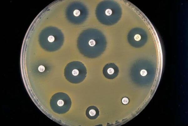 Cultivo y antibiograma