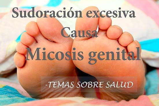 Micosis genital