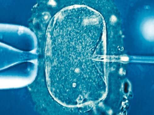 esterilidad. tratamiento 2