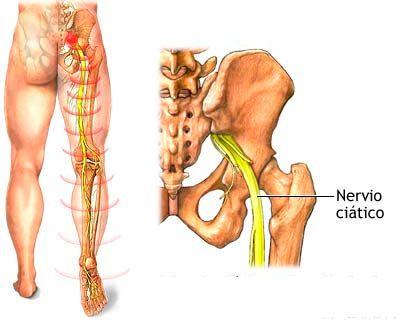 Detalle del nervio ciatico