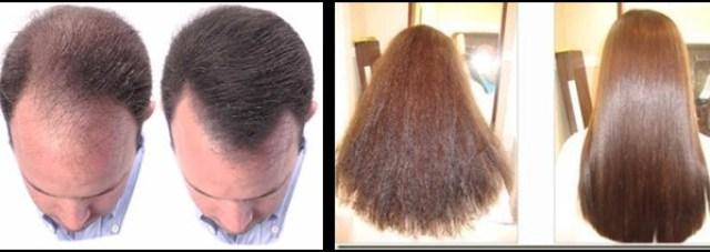 como evitar la caída del cabello acelerar el crecimiento del cabello